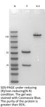 Anti-Human IL-6(Olokizumab)