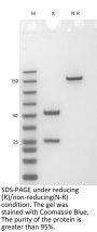 Anti-Human EGFL7(Parsatuzumab)