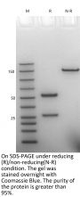 Anti-Human Claudin 18.2 [Zolbetuximab/IMAB362 Biosimilar]