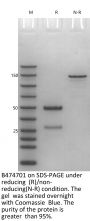 Anti-Human FcRn(Nipocalimab)