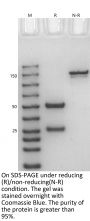 V6 Anti-Human FcRn (Batoclimab)