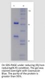 V6 Anti-Human ADM (Enibarcimab)