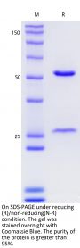 Anti-Human PD-L1(Durvalumab