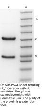 Anti-Human CD3 epsilon OKT-3(Muromonab)