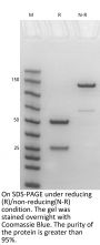 Anti-Human CD14(Atibuclimab)