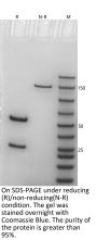Anti-Human CA9(Girentuximab)