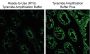 Tyramide Amplification Buffer Plus, 250 reactions