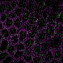 EverBrite TrueBlack® Hardset Mounting Medium with DAPI