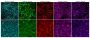 CytoLiner™ 570/590 Fixed Cell Membrane Stain, 1000 labelings