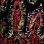 Tyramide Amplification Kit with HRP Goat Anti-Rabbit and CF®568 Tyramide