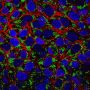 LipidSpot™ 488 Lipid Droplet Stain
