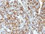 Mucin 1 / EMA / Episialin / CD227(MUC1/520), CF405S conjugate, 0.1mg/mL