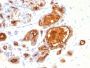 MUC1 / CA15-3 / EMA / CD227 (Epithelial Marker)(115D8),  CF405S conjugate, 0.1mg/mL