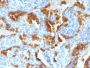 Cytokeratin 8(H1 + TS1), CF405S conjugate, 0.1mg/mL