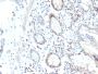 RAD51 (Prognostic and Response to Chemotherapy Marker)(RAD51/2702), CF405S conjugate, 0.1mg/mL