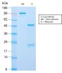 ACTH (Adrenocorticotrophic Hormone) (C-Terminus)(CLIP/2859R), CF405S conjugate, 0.1mg/mL