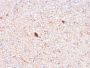 Serum Amyloid P / APCS(APCS/3240), CF405S conjugate, 0.1mg/mL