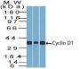Cyclin D1(DCS-6), CF640R conjugate, 0.1mg/mL