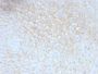 CD59 (heavy chain of Protectin)(MACIF/629), CF640R conjugate, 0.1mg/mL