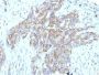 CD56 / NCAM(123C3.D5 + 123A8), CF640R conjugate, 0.1mg/mL