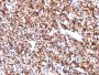 Carbonic Anhydrase IX(CA9/781), CF640R conjugate, 0.1mg/mL