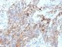 CD56 / NCAM(NCAM1/795), CF640R conjugate, 0.1mg/mL
