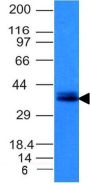 Ep-CAM / CD326(EGP40/1120), CF640R conjugate, 0.1mg/mL