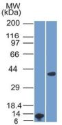 Arginase 1 (Hepatocellular Carcinoma Marker) (ARG1/1125) , CF640R conjugate, 0.1mg/mL