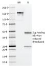 Arginase 1 (Hepatocellular Carcinoma Marker) (ARG1/1126) , CF640R conjugate, 0.1mg/mL