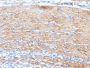 Myosin, Smooth Muscle Heavy Chain(MYH11/923 + SMMS-1), CF640R conjugate, 0.1mg/mL