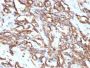 Vimentin(VM1170), CF640R conjugate, 0.1mg/mL