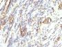 Vimentin(VM1170), CF640R conjugate, 0.1mg/mL