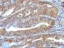 Vimentin(VM1170), CF640R conjugate, 0.1mg/mL