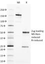 Ep-CAM / CD326 (Extracellular Domain) (Epithelial Marker) (EGP40/1373), CF640R conjugate, 0.1mg/mL