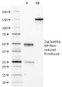 Ferritin, Light Chain (FTL) (Microglia Marker) (FTL/1388), CF640R conjugate, 0.1mg/mL