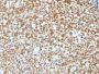 NKX2.2 (Neuroendocrine & Ewing s Sarcoma Marker) (NX2/1422R), CF640R conjugate, 0.1mg/mL