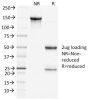 Clathrin, Heavy Chain(CHC/1432), CF640R conjugate, 0.1mg/mL