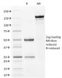 Filaggrin (Keratinocyte Differentiation Marker) (FLG/1561), CF640R conjugate, 0.1mg/mL