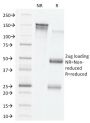 VEGF (Vascular Endothelial Growth Factor)(VG76e), CF640R conjugate, 0.1mg/mL