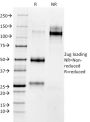 MMP3 (Marker of Metastasis and Rheumatoid Arthritis)(MMP3/1730), CF640R conjugate, 0.1mg/mL