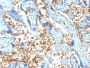 Spectrin Alpha 1 (Erythrocyte Marker) (SPTA1/1810), CF640R conjugate, 0.1mg/mL
