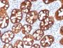 Ep-CAM / CD326 (Epithelial Marker) (rMOC-31), CF640R conjugate, 0.1mg/mL