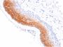 Cytokeratin 1 (Suprabasal Keratinocyte Marker)(KRT1/1840), CF640R conjugate, 0.1mg/mL