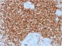 Bcl-2 (Apoptosis & Follicular Lymphoma Marker) (BCL2/1878R), CF640R conjugate, 0.1mg/mL