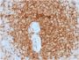 Bcl-2 (Apoptosis & Follicular Lymphoma Marker) (rBCL2/796), CF640R conjugate, 0.1mg/mL