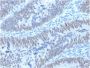 CDX2 / Caudal Type Homeobox 2 (GI Epithelial Marker) (PCRP-CDX2-1A3), CF640R conjugate, 0.1mg/mL