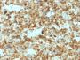 gp100 / Melanosome / PMEL17 / SILV (Melanoma Marker) (PMEL/2037), CF640R conjugate, 0.1mg/mL