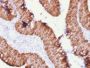 Ep-CAM / CD326 (Extracellular Domain) (Epithelial Marker) (rEGP40/1372), CF640R conjugate, 0.1mg/mL
