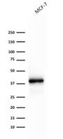 Ep-CAM / CD326 (Extracellular Domain) (Epithelial Marker) (rEGP40/1372), CF640R conjugate, 0.1mg/mL