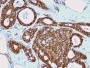Catenin, beta (CTNNB1) (rCTNNB1/2173), CF640R conjugate, 0.1mg/mL